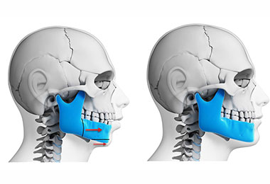 Charlotte Corrective Jaw Surgery